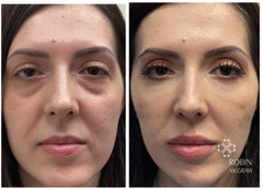 Bright Eye Miracle - Instant Under Eye Bag Removal Cream