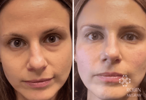 Bright Eye Miracle - Instant Under Eye Bag Removal Cream