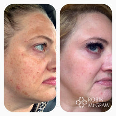 To The Point - Dark Spot Corrector